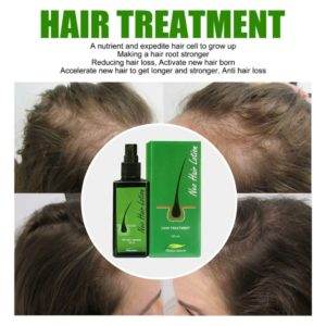 Neo Hair Treatment